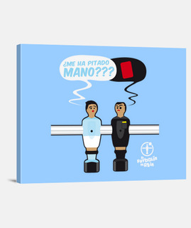 ME HA PITADO MANO Celta LB