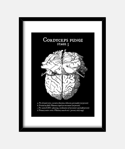 Quadro cervello clicker le of