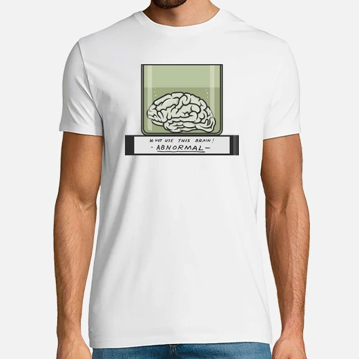 cervello anormale - frankenstein junior